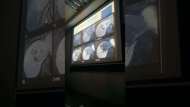 u gan HNF VA ADENOMA 3 смотреть онлайн