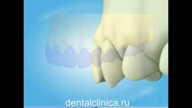 European Clinic of Aesthetic Dentistry Имплантация протезирование эстетическая хирургия ортодонтия смотреть онлайн