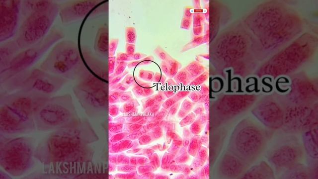 Differnet Mitosis Stages of Onion root tip. #cells #mitosis #microscope смотреть онлайн