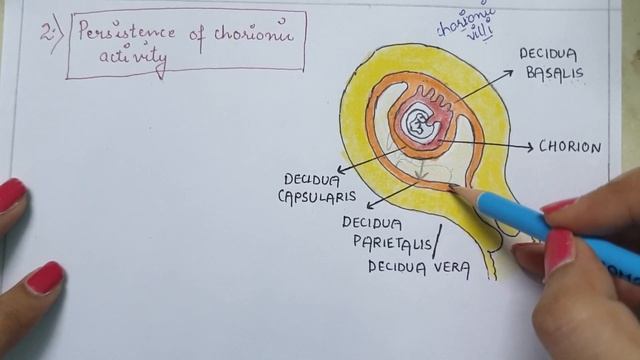 PLACENTA PRAEVIA PART 1 (Unit-7 OBG- HIGH RISK PREGNANCY) смотреть онлайн