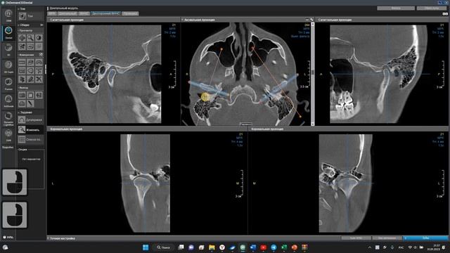 OD3D Построение ВНЧС