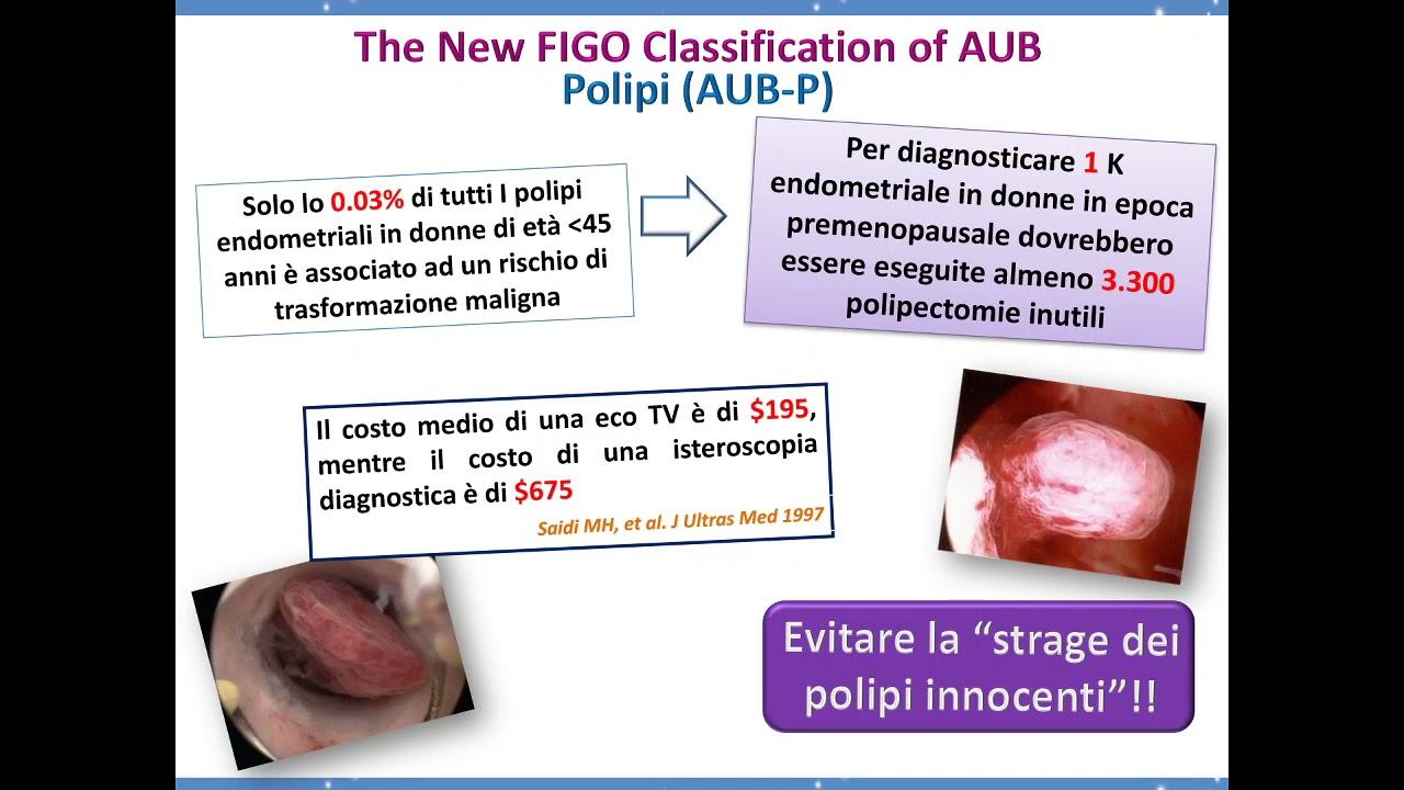 6 Ginecologia Patologie uterine benigne Sanguinamenti uterini anomali e isteroscopia смотреть онлайн
