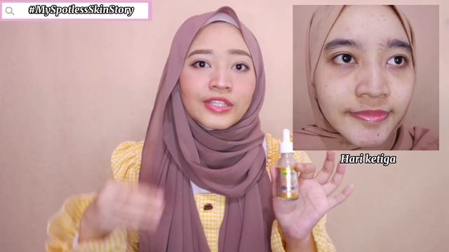 REVIEW GARNIER LIGHT COMPLETE VIT. C BOOSTER SERUM SETELAH 1 MINGGU PEMAKAIAN смотреть онлайн