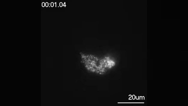 InsulinSecretion смотреть онлайн