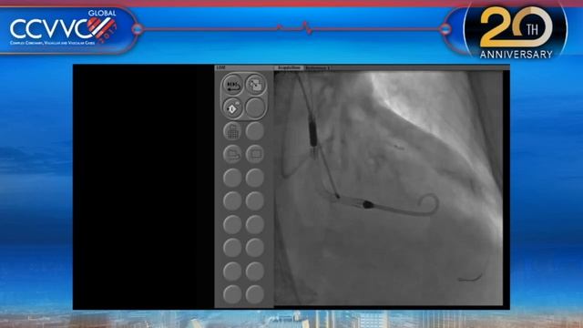 LIVE CASE PRESENTATIONS #8, #9, #10 and #11 смотреть онлайн