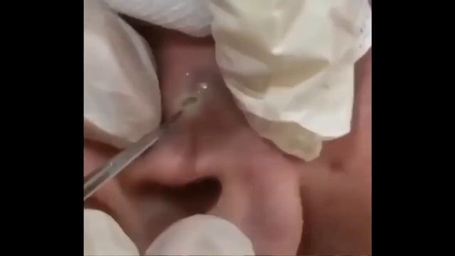 УЖАССС! ПРЫЩИ В УШАХ! смотреть онлайн