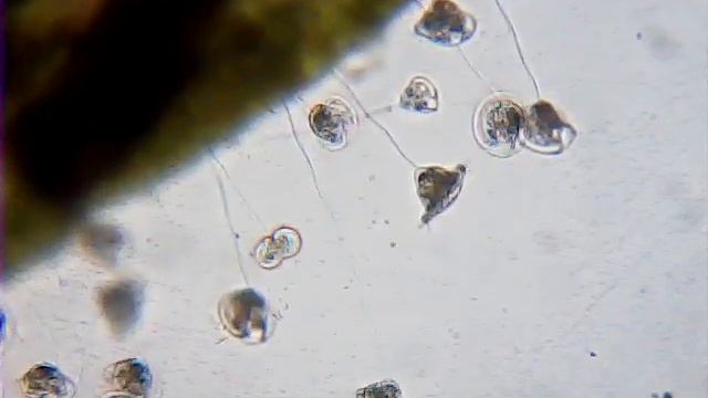Vorticella смотреть онлайн