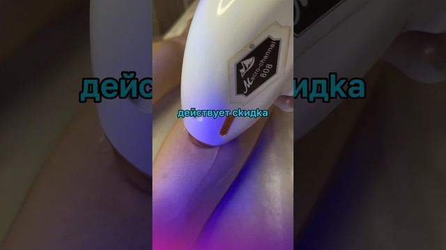 Лазерная эпиляция #косметология #эпиляция #лазернаяэпиляция #epilation #лифтинглица #beauty смотреть онлайн