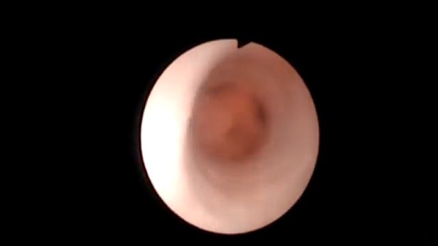 opuholi mochetonika смотреть онлайн