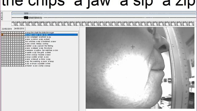 Image analysis tutorial 2 Scaling 2D splines so they measure in mm смотреть онлайн
