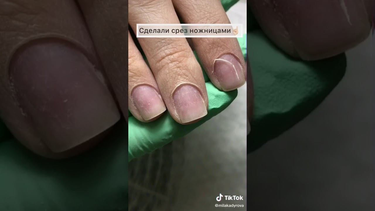 налипшая кутикула и как я с ней боролась смотреть онлайн
