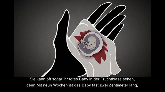 Chemische Abtreibung im 1. Trimester смотреть онлайн