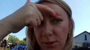 ❤️Удаление перманентного макияжа бровей лазером. Мой опыт.