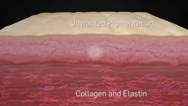 PicoSure Laser Skin Revitalization смотреть онлайн