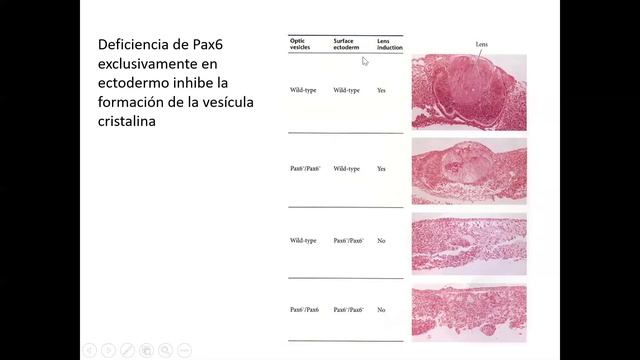Desarrollo nervioso 3, cresta neural y organos de los sentidos смотреть онлайн