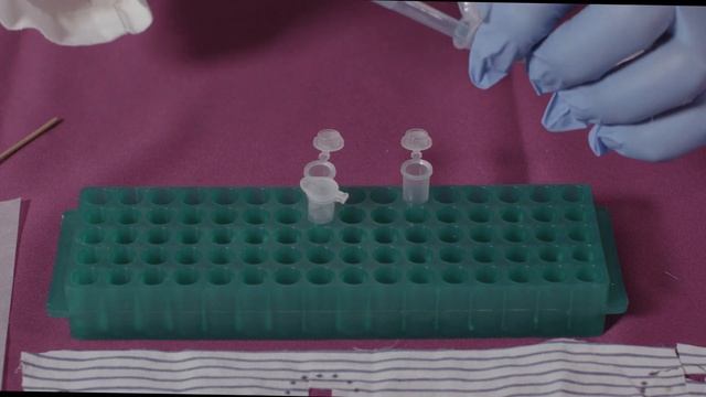 PSA Semiquant Forensic Test: detection of seminal fluid смотреть онлайн