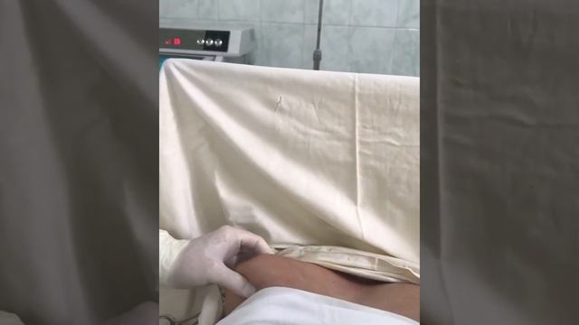 Гинекомастия смотреть онлайн