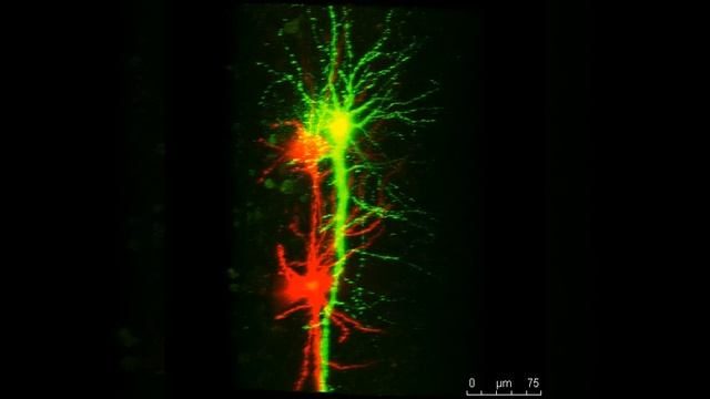 Double labeled neurons of brain slices смотреть онлайн