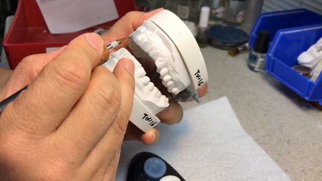 Mock-Up Wax-Up for the Doctor's Direct Composite смотреть онлайн
