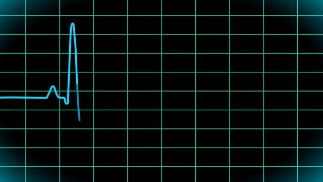 кардиограмма
