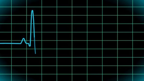 кардиограмма
