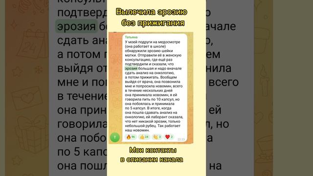 Вылечила эрозию, онкология не подтвердилась#эрозия#эрозияшейкиматки смотреть онлайн
