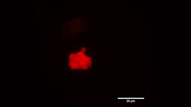 Cell spreading - Linfocitos B de ratón смотреть онлайн