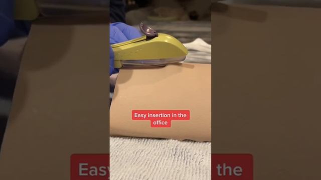 Nexplanon birth control implant insertion смотреть онлайн