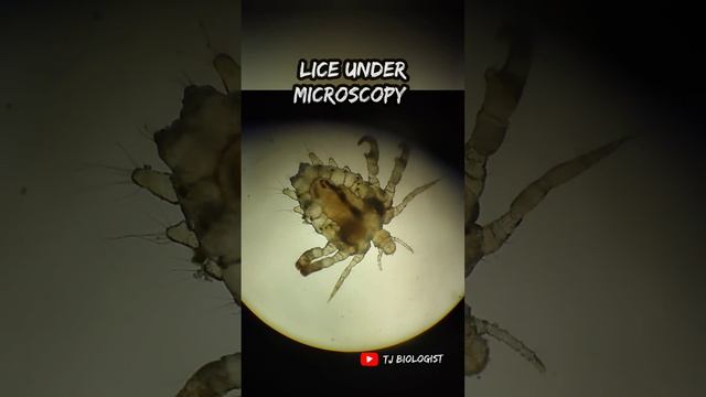 Lice under microscopy| parasite | parasitology| Arthropoda| adult|live|Tjbiologist| смотреть онлайн