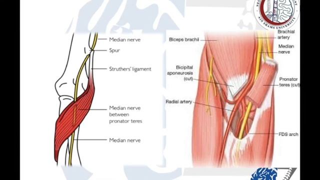 Entrapment Neuropathy (1): Median Nerve (1) : Anatomy العصب الأوسط смотреть онлайн