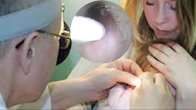 Clean and Removal ear _ She need clean ear смотреть онлайн