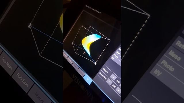 Consultatie optometrica cu DNEye Scanner+2 Rodenstock смотреть онлайн