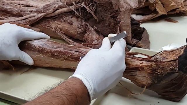 Rao Lab 6 Lower Limb p1 смотреть онлайн
