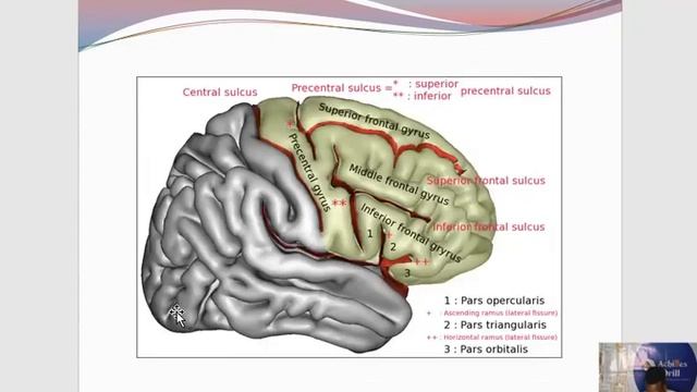 SUPEROLATERAL VIEW of the Brain ||Common NEUROANATOMY STEEPLECHASE Questions (PART 1) смотреть онлайн