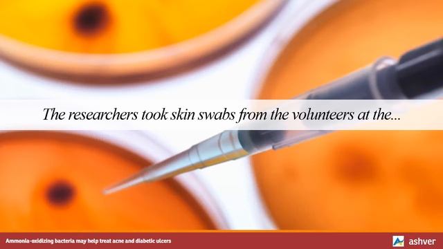 Ammonia oxidizing bacteria may help treat acne and diabetic ulcers смотреть онлайн