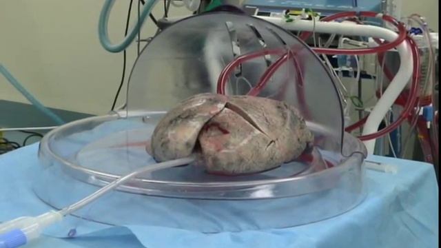 Toronto EX VIVO Lung Perfusion System смотреть онлайн