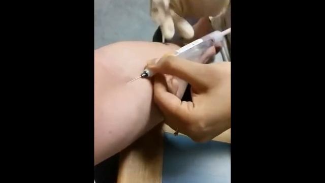 Pernicious Anaemia Blood Test & B12 Injection смотреть онлайн