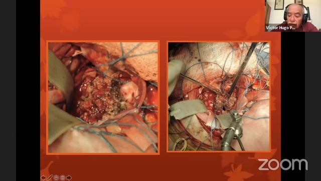 Anatomy of the Middle Cerebral Artery смотреть онлайн