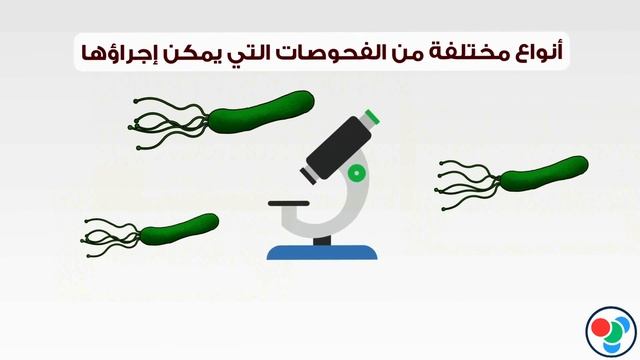 فحص جرثومة المعدة Helicobacter Pylori (H. pylori) Test смотреть онлайн