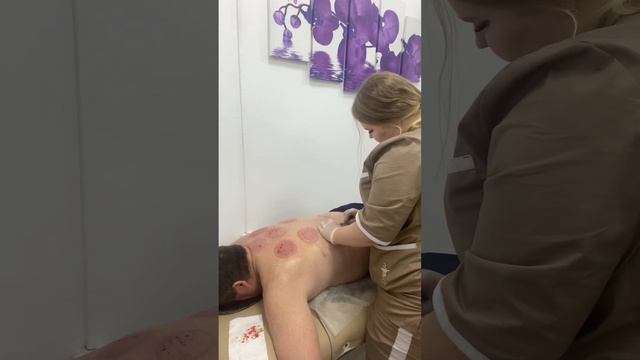 Небольшой процесс проведения хиджамы ! смотреть онлайн