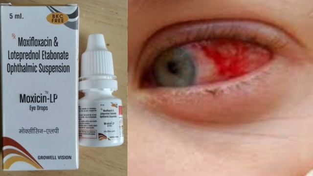 Moxicin - LP || Moxifloxacin LP || Uses || Bacterial Infection || Optometry Solution