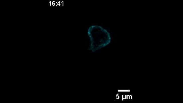 Johns Hopkins Medicine Scientists Engineer Immune Cells to Follow the Light смотреть онлайн