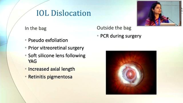 KSOS2022 Dr Chaitra Jayadev D1 HA S4 T Posterior segment complications of cataract surgery смотреть онлайн