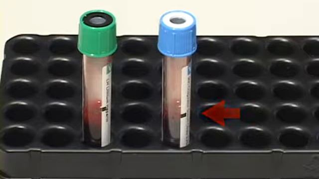 VerifyNow: Sample Collection Procedure смотреть онлайн