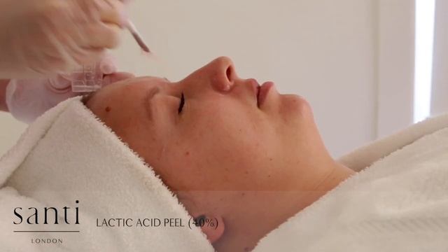 Santi Skin Peel using Lactic Acid смотреть онлайн