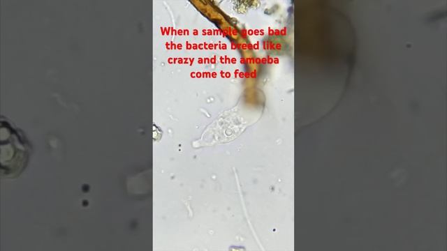 Sample overrun with bacteria and amoeba #microscope #biology #science #microscopy смотреть онлайн