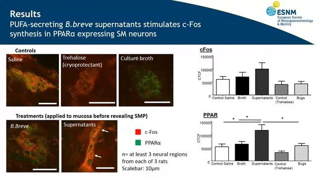 Bifidobacterium Breve NCFB 2258 stimulates vagal nerve firing across by Dervla O'Malley смотреть онлайн