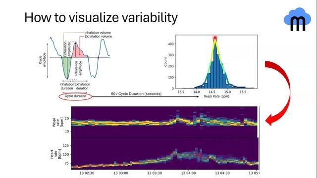 An Approach to Visualize and Detect Features of Brain Injury Progression смотреть онлайн