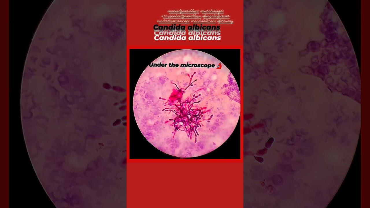 candida albicans under the Microscope🔬🔬🔬🔬#naheedzainsiddiqui #microbiology #february2023 #111#777#1 смотреть онлайн