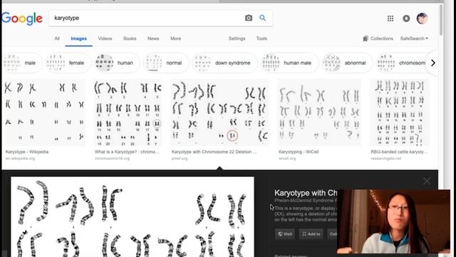 Genetics Lecture 4 Karyotype Review смотреть онлайн
